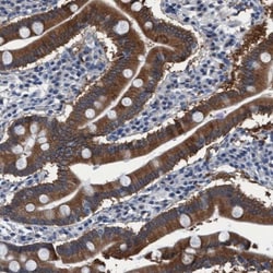 Wnt-7a Antibody, Novus Biologicals:Antibodies:Primary Antibodies